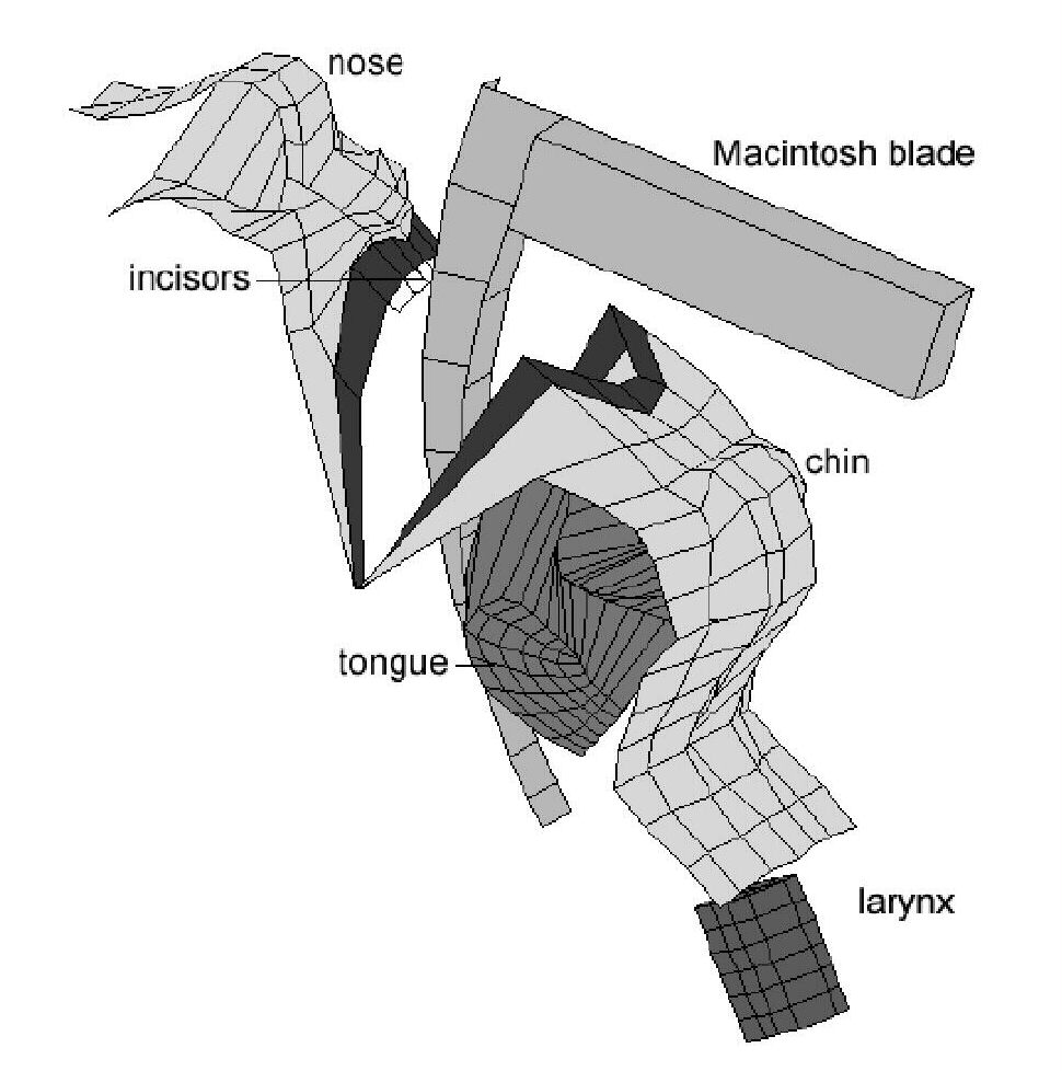 rigid laryngoscope